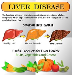 best diet for liver disease