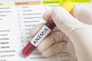 anemia health problem
