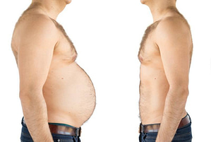 Before and after views of a man after dieting