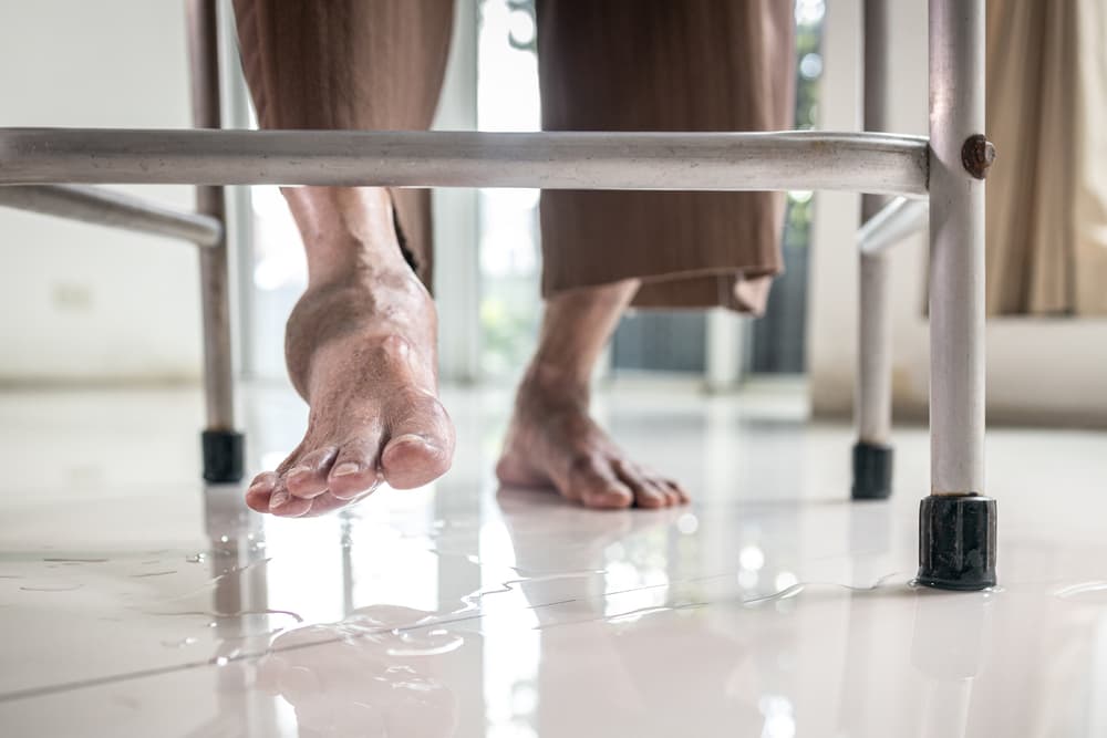 foot drop treatment