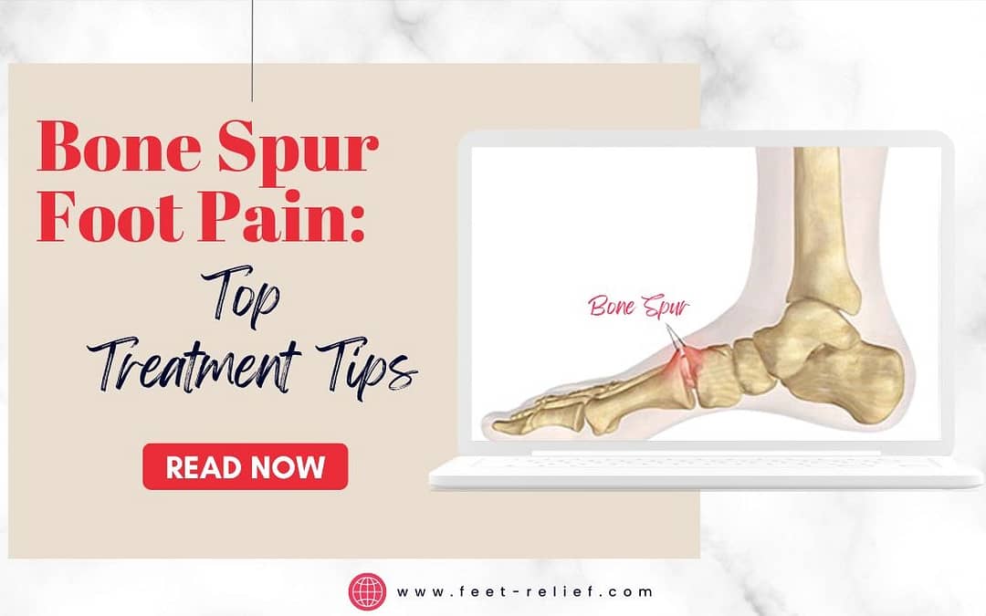 Bone Spur Foot Pain Top Treatment Tips