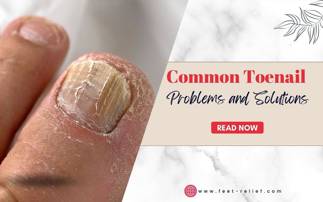 Common Toenail Problems and Solutions