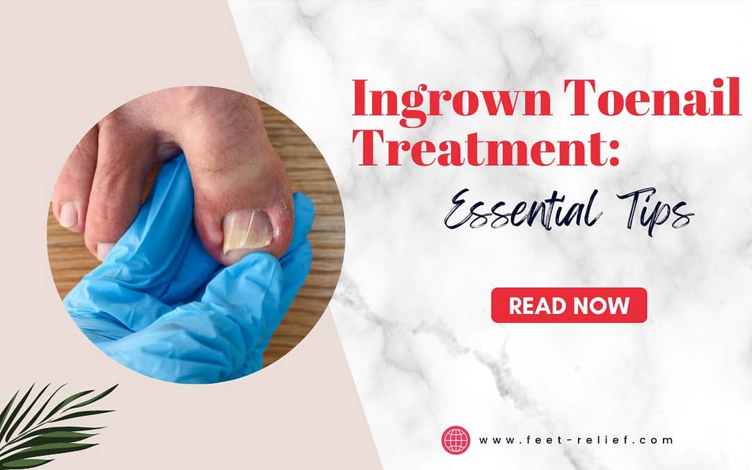 Ingrown Toenail Treatment Essential Tips