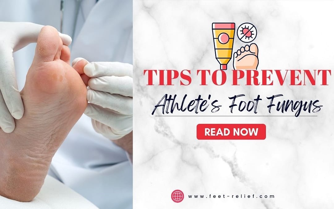 Tips to Prevent Athlete's Foot Fungus