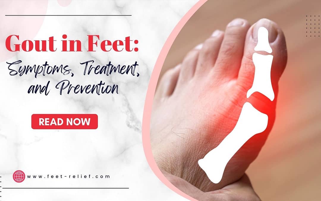 Gout in Feet: Symptoms, Treatment, and Prevention