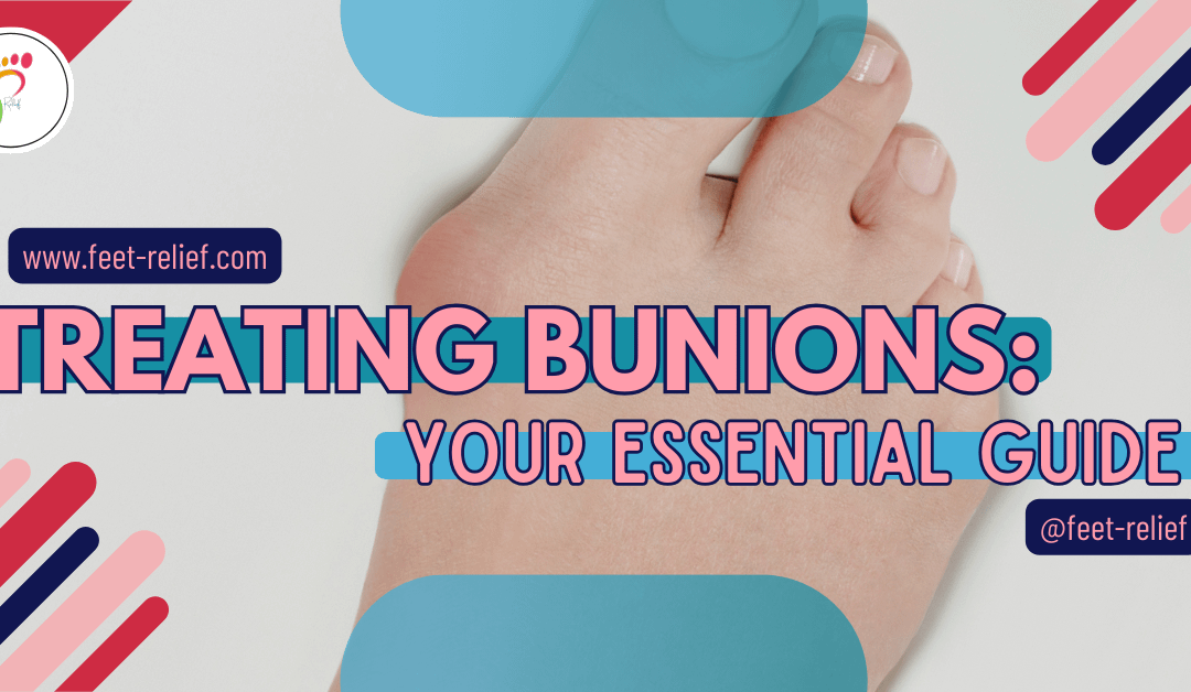 Treating Bunions: Your Essential Guide