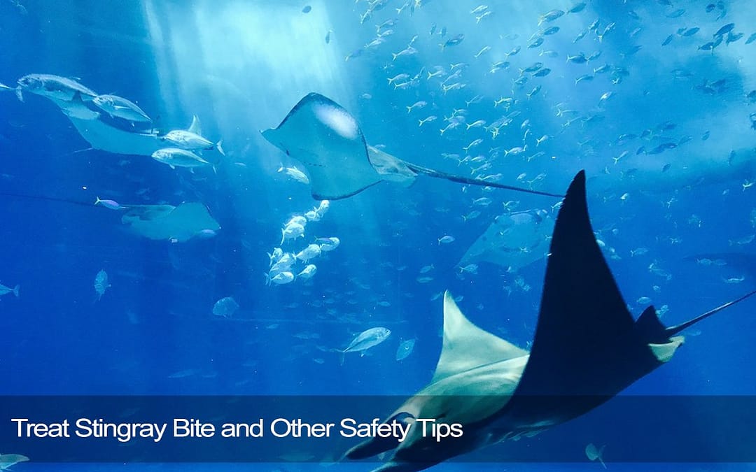 Treat Stingray Bite and Other Safety Tips