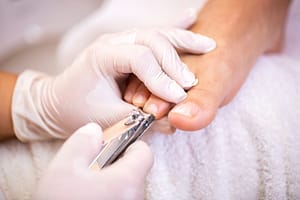 How to Trim Toenails and Fingernails in Elderly