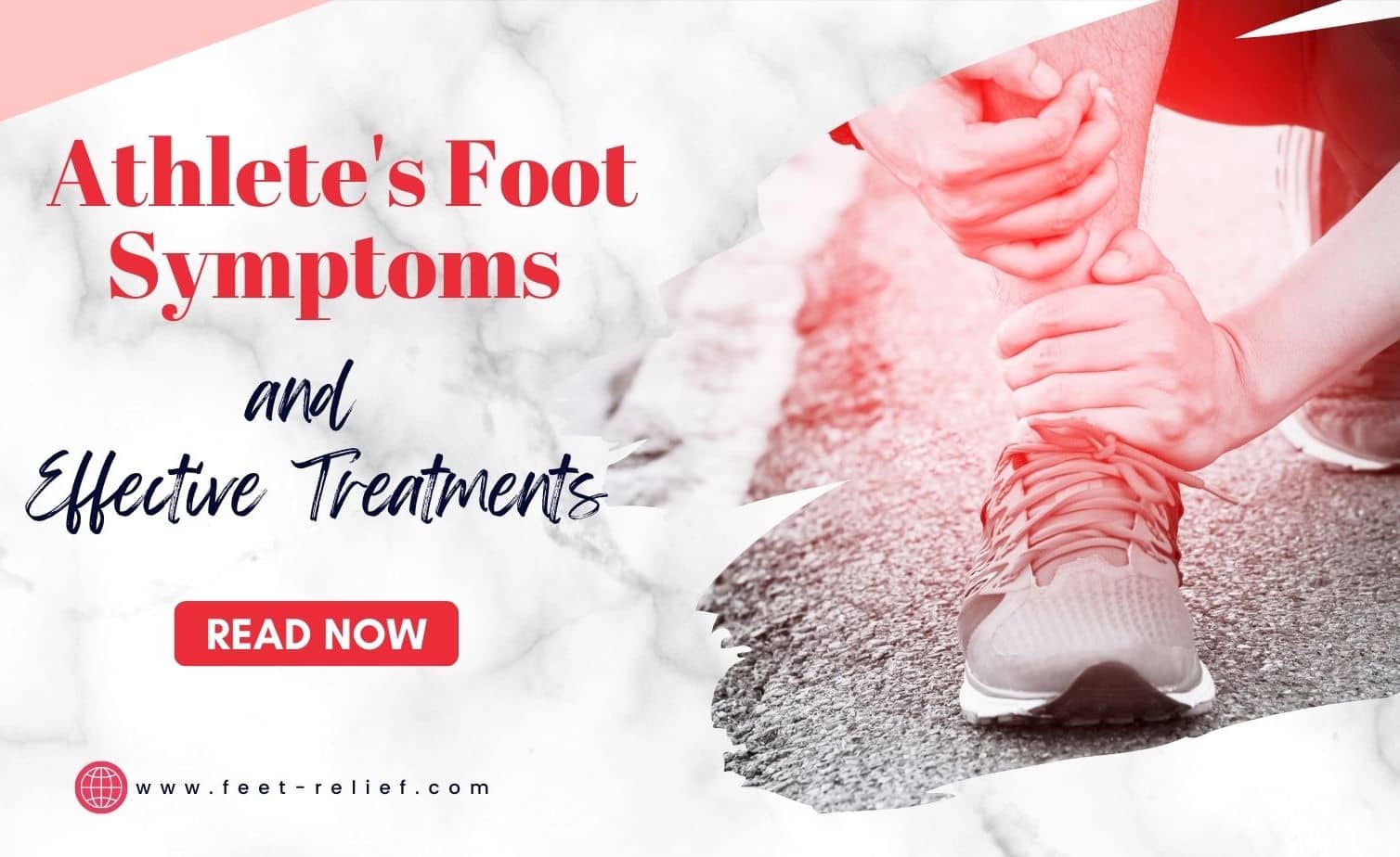 Athlete's Foot Symptoms and Effective Treatments - Feet Relief